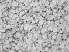 tejido adiposo marrón o pardo tejido adiposo marrón o pardo